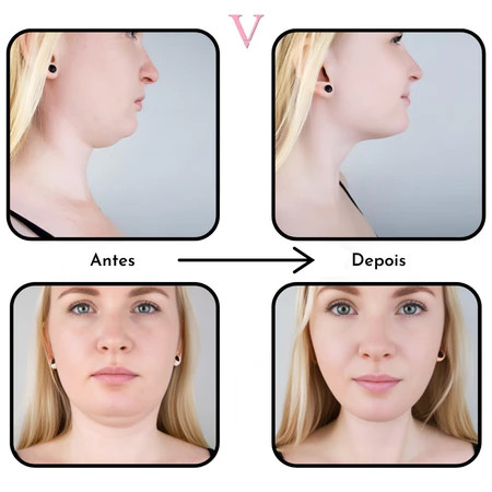 Máscara de Contorno Facial - MC - Revitalize seu Rosto.